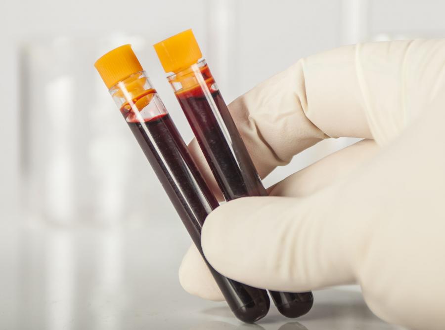 Anemia